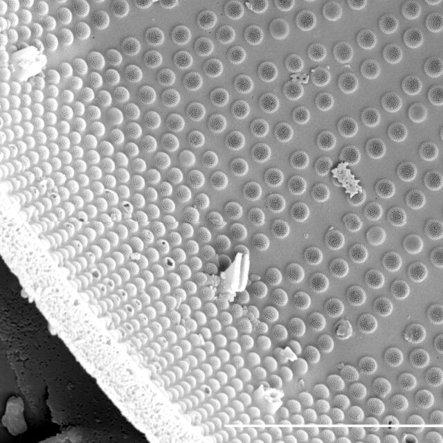 Stephanodiscus yellowstonensis SEM1