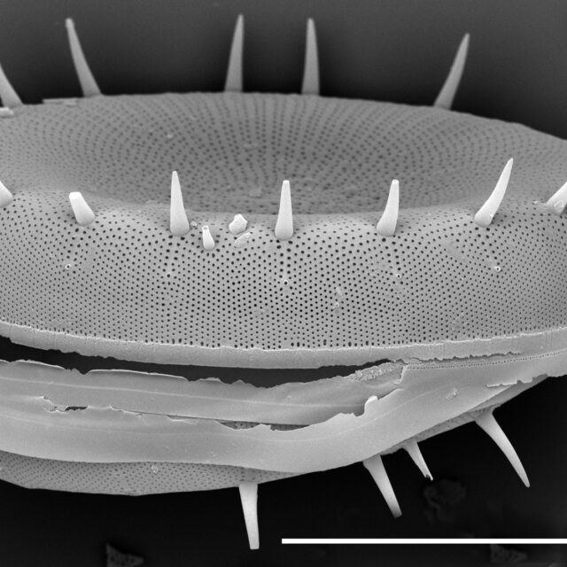 Stephanodiscus yellowstonensis SEM3