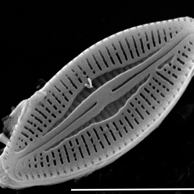 Microcostatus krasskei SEM4