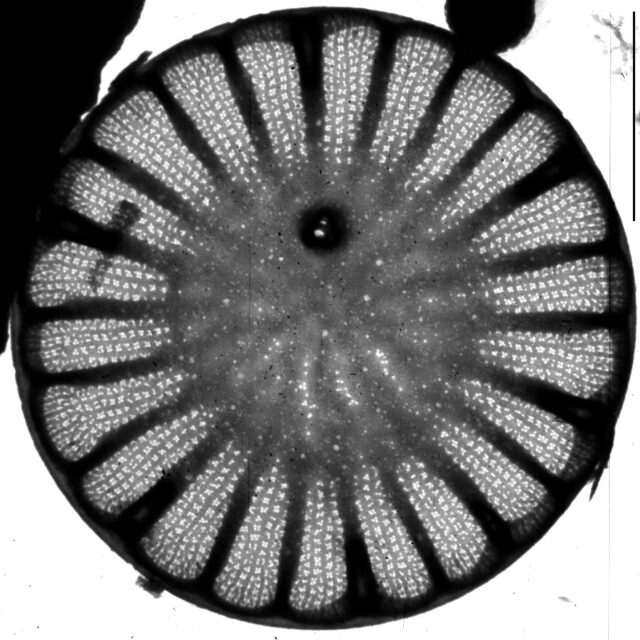 Cyclotella atomus TEM1