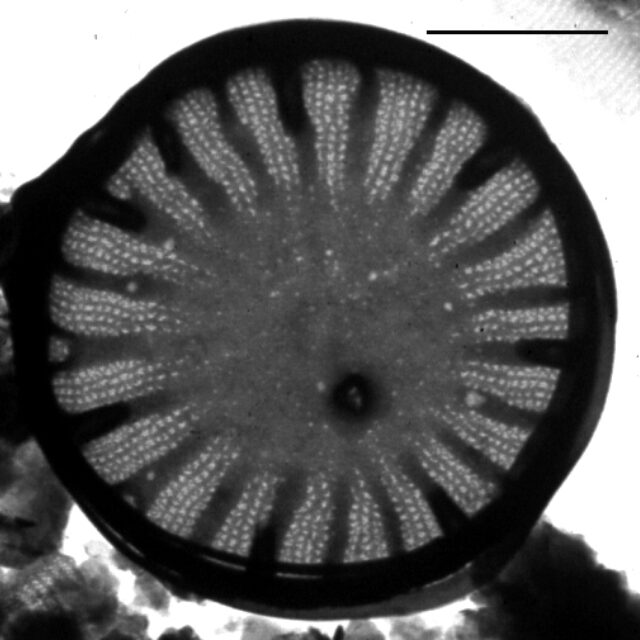 Cyclotella atomus TEM2