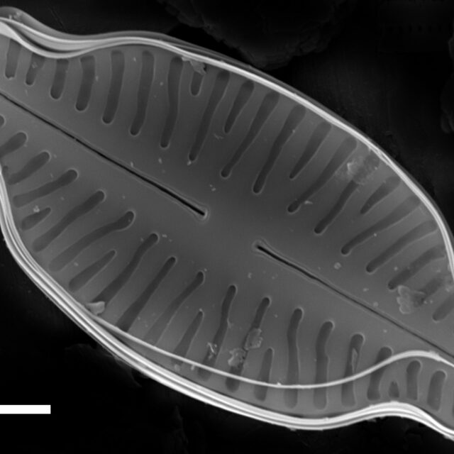 Karayevia laterostrata SEM1