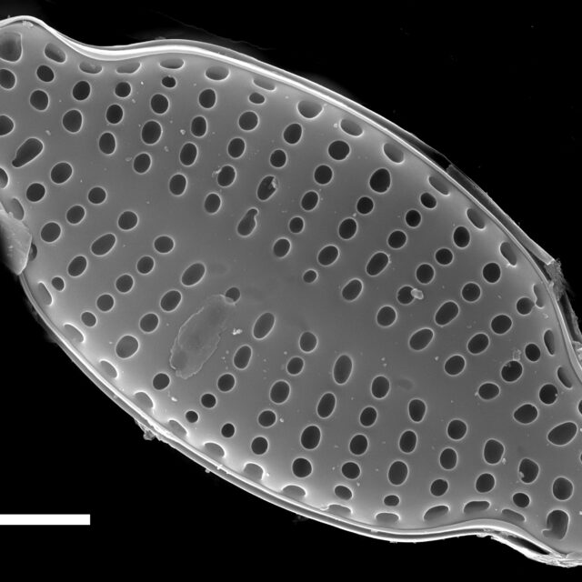 Karayevia laterostrata SEM3