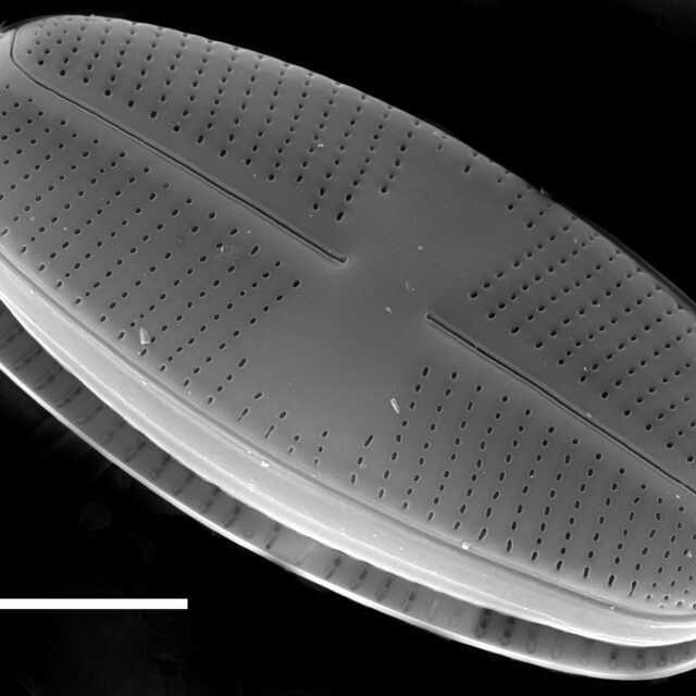 Psammothidium helveticum SEM1