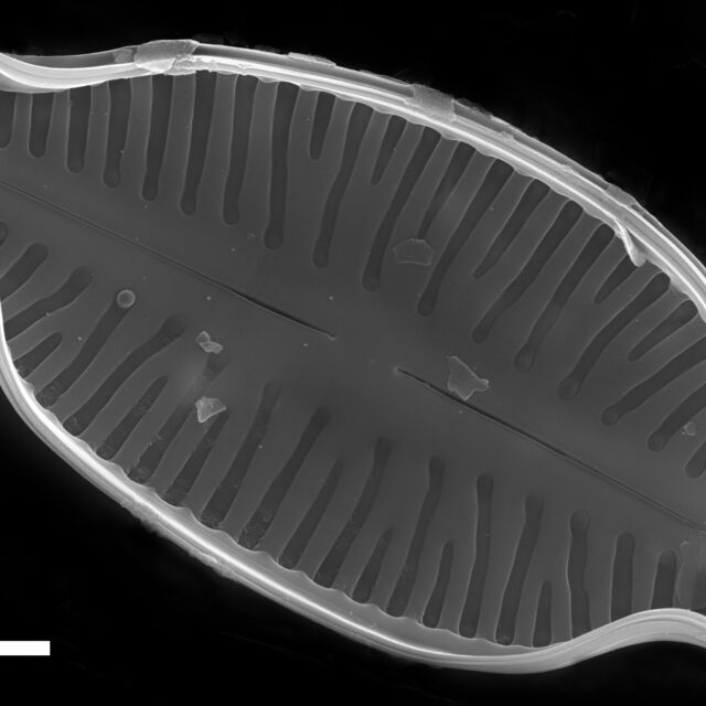 Karayevia laterostrata SEM4