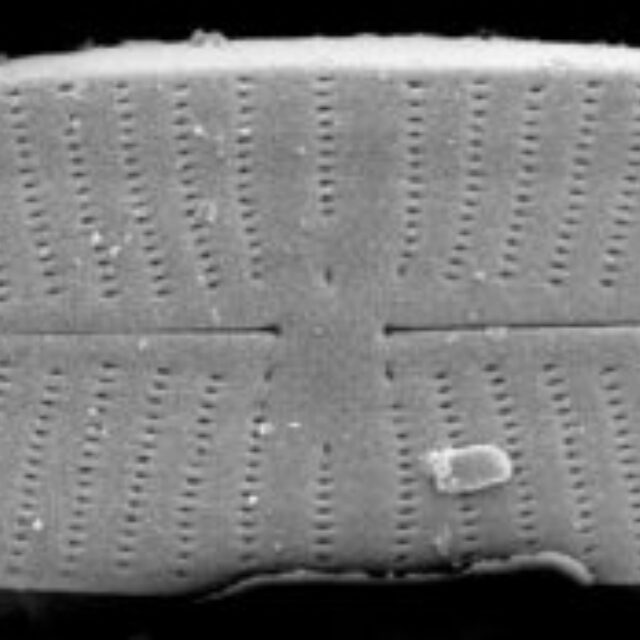 Geissleria punctifera SEM1