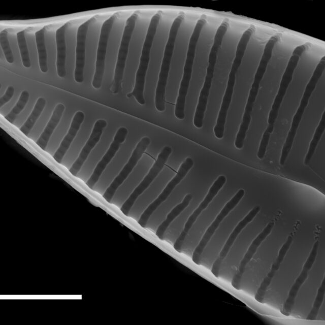 Cymbella turgidula SEM3