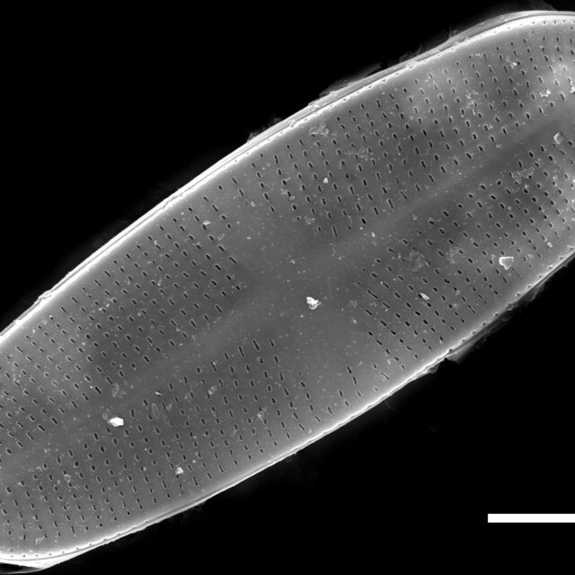 Psammothidium chlidanos SEM2