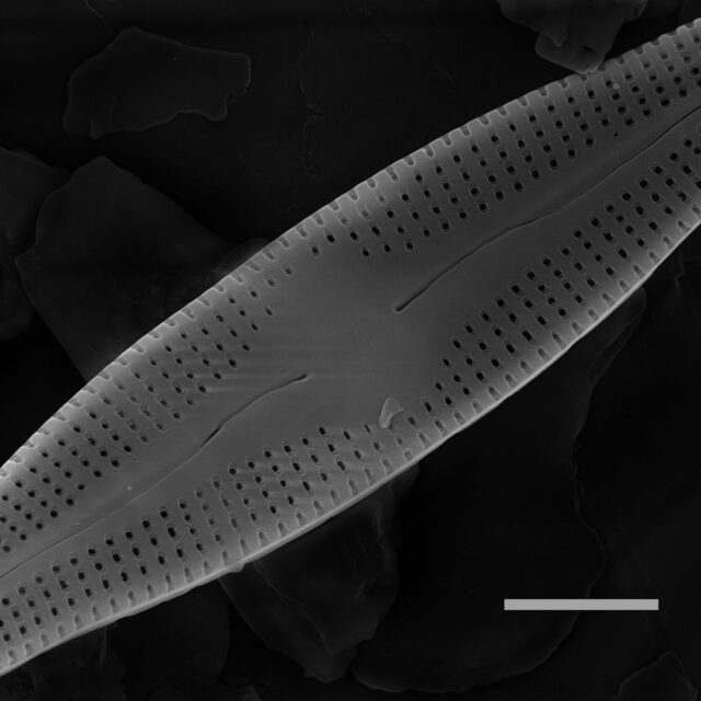 Nupela elegantula SEM2