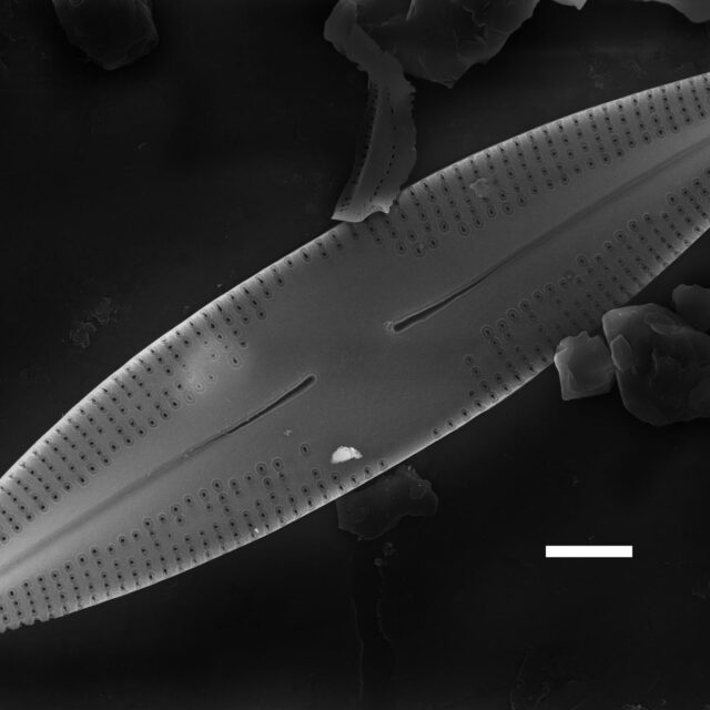 Nupela poconoensis SEM3