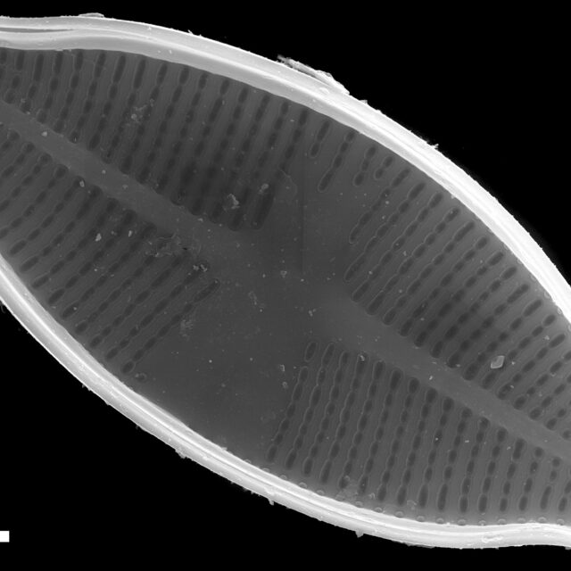 Psammothidium harveyi SEM1