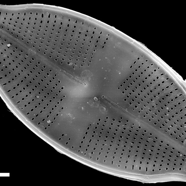 Psammothidium harveyi SEM2