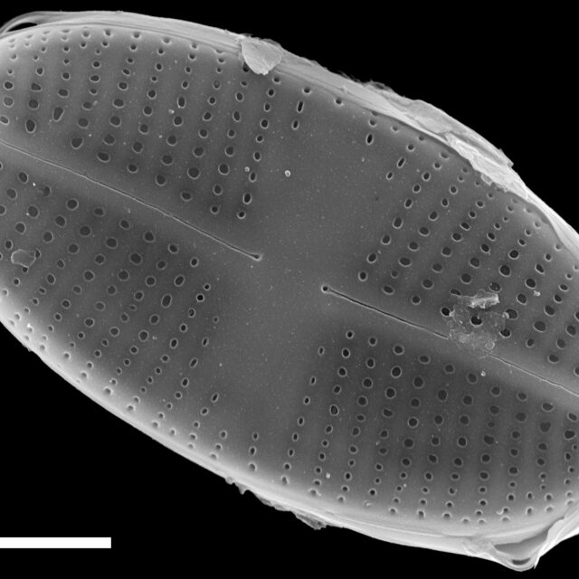 Psammothidium pennsylvanicum SEM3