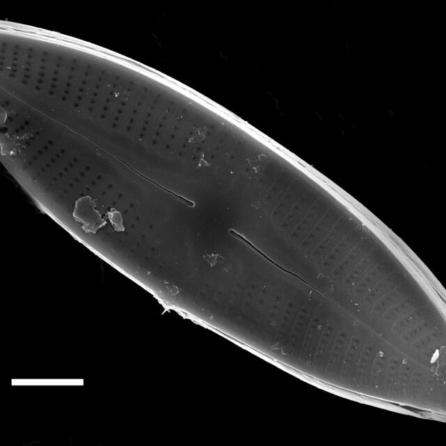 Nupela lapidosa SEM2