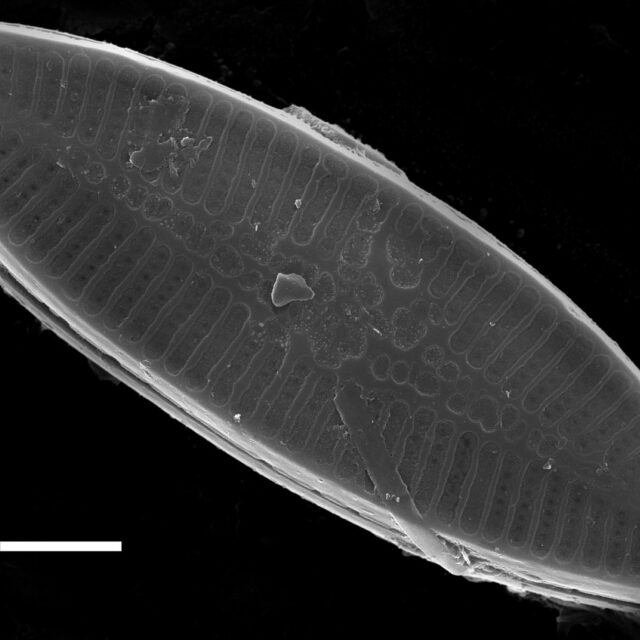 Nupela lapidosa SEM3