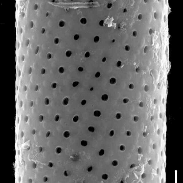 Aulacoseira subarctica SEM1