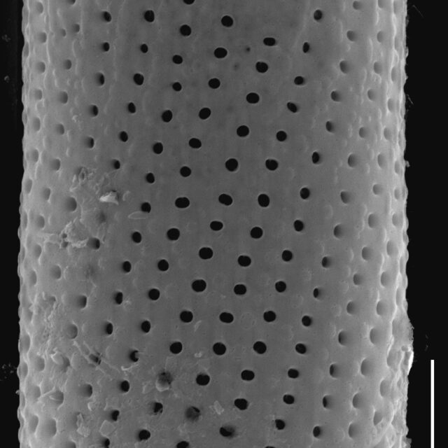 Aulacoseira subarctica SEM2