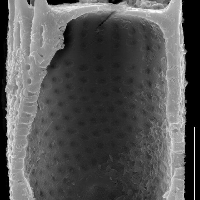 Aulacoseira subarctica SEM3