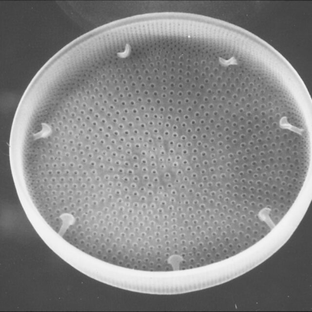 Actinocyclus normanii SEM1