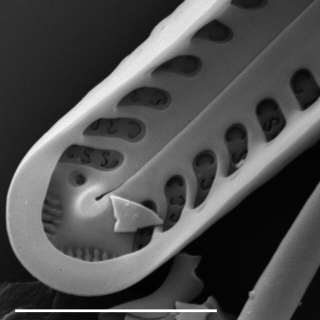 Gomphonema NOT-commutatum SEM1