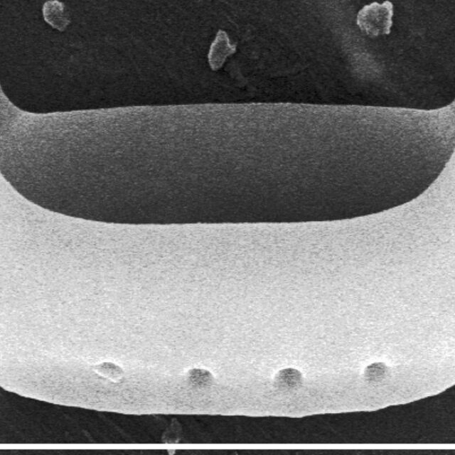 Diprora haenaensis SEM2