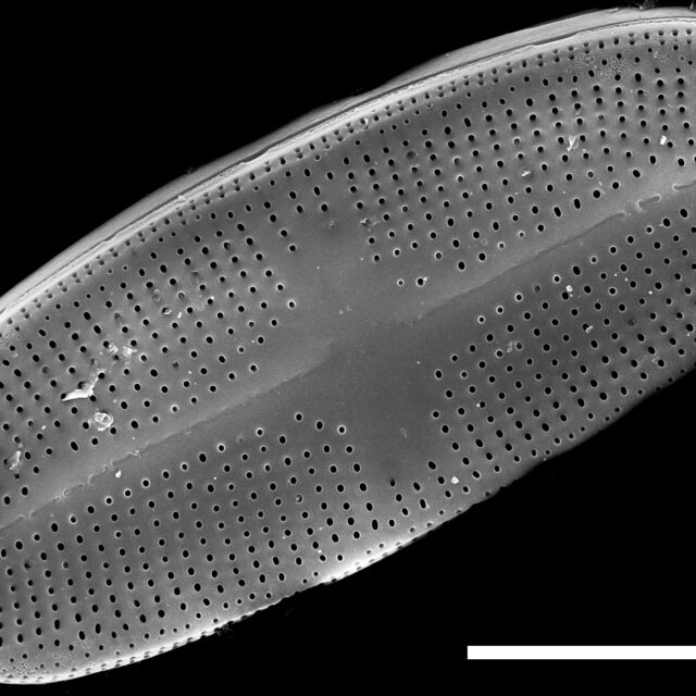 Psammothidium alpinum SEM1