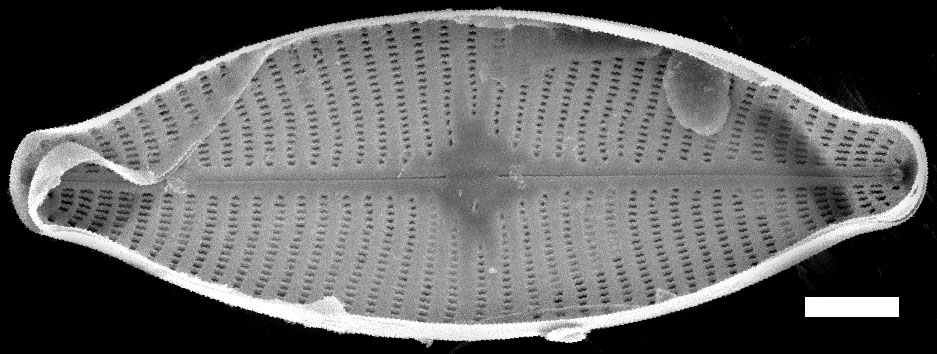 Geissleria lateropunctata SEM1