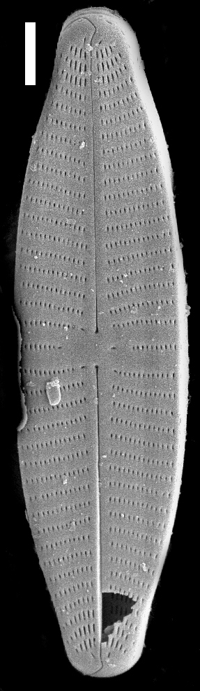 Geissleria punctifera SEM2