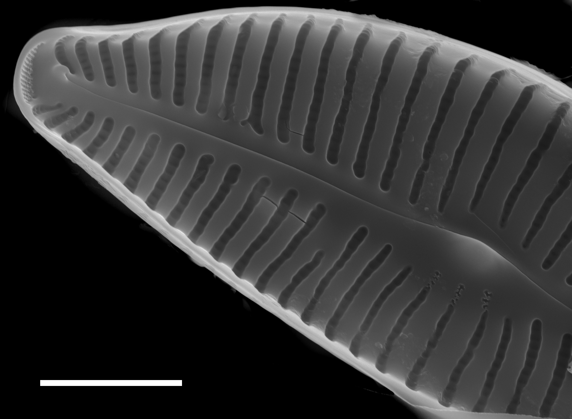 Cymbella turgidula SEM3