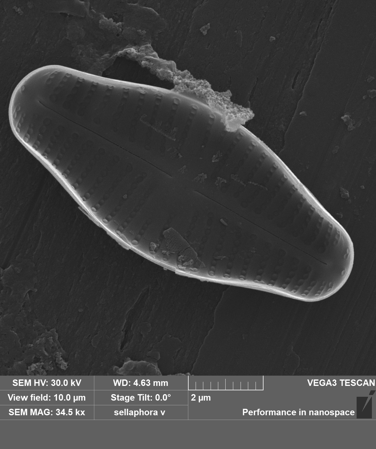 Sellaphora vere SEM2